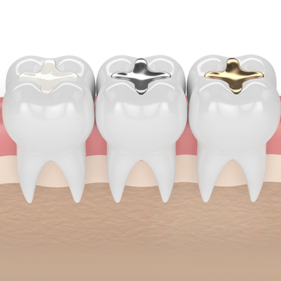 Alt- Treatments